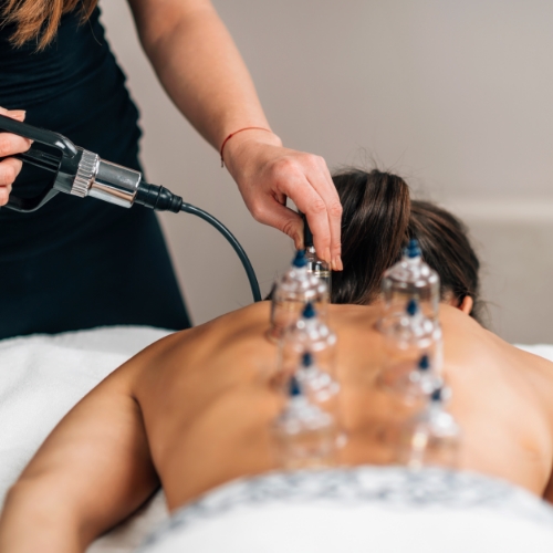 Cupping-Therapy-PhysioCare-Rehab-and-Wellness-Brandywine-MD